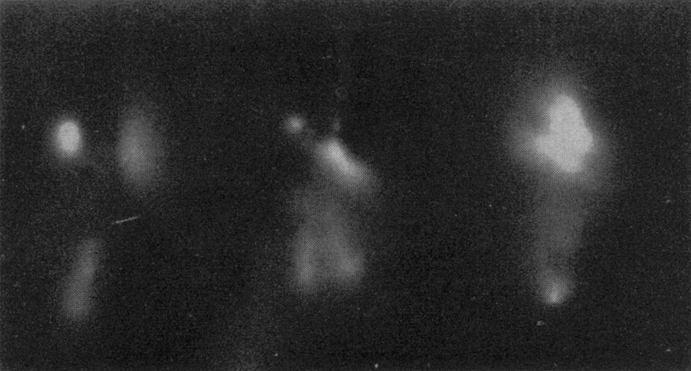 A dark X ray style film showing pale glowing shapes of teeth made by their own radioactivity.